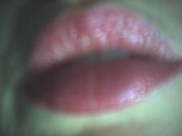 kiss